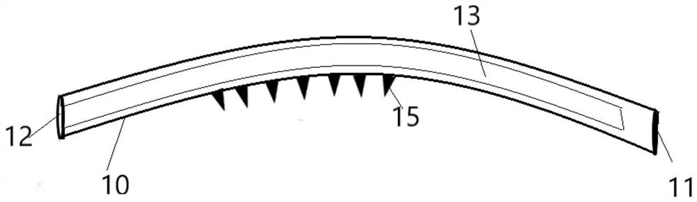 Schlemm canal dilatation stent and dilatation method