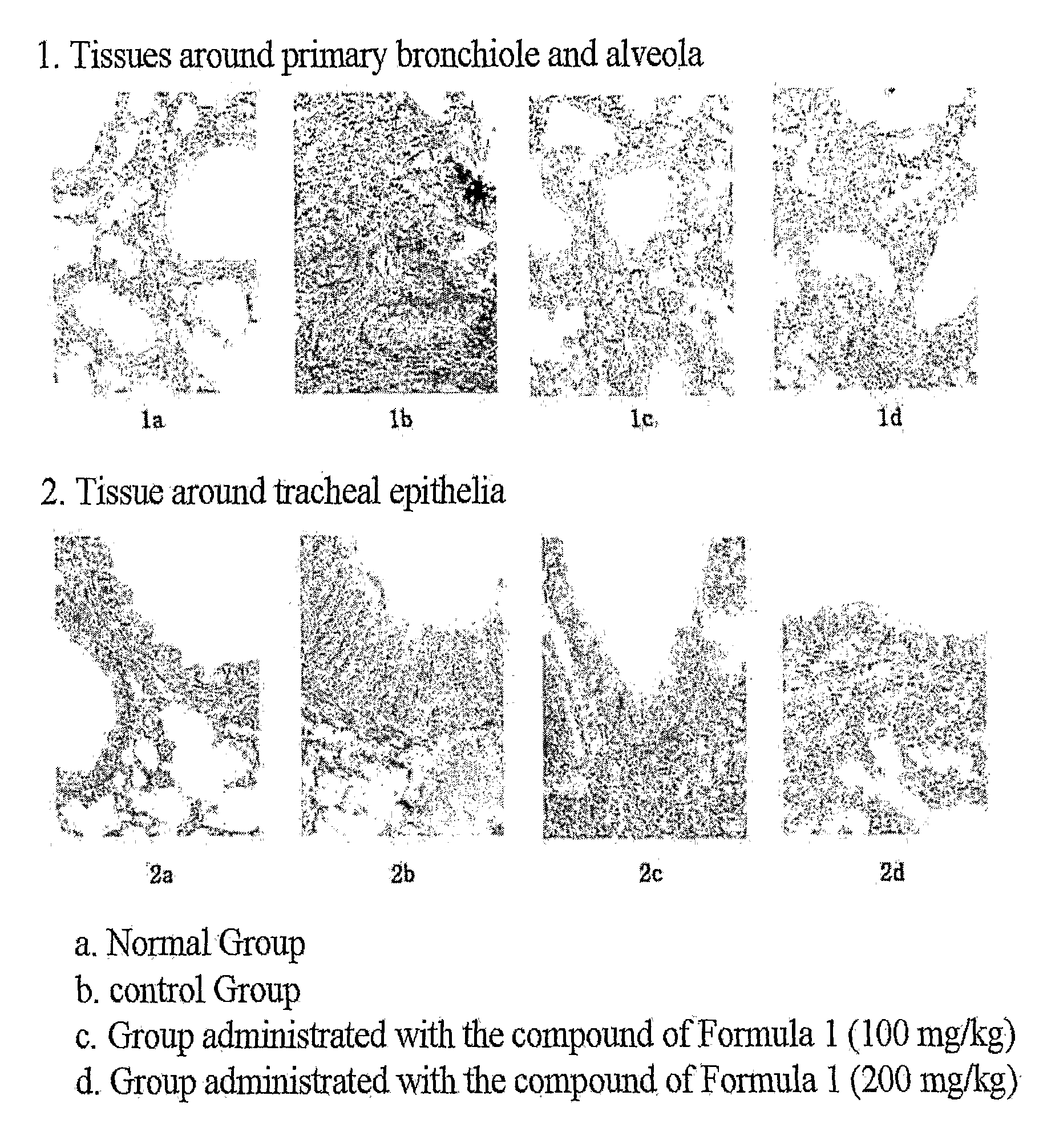 Composition for the Prevention and Treatment of Allergic Inflammatory Disease