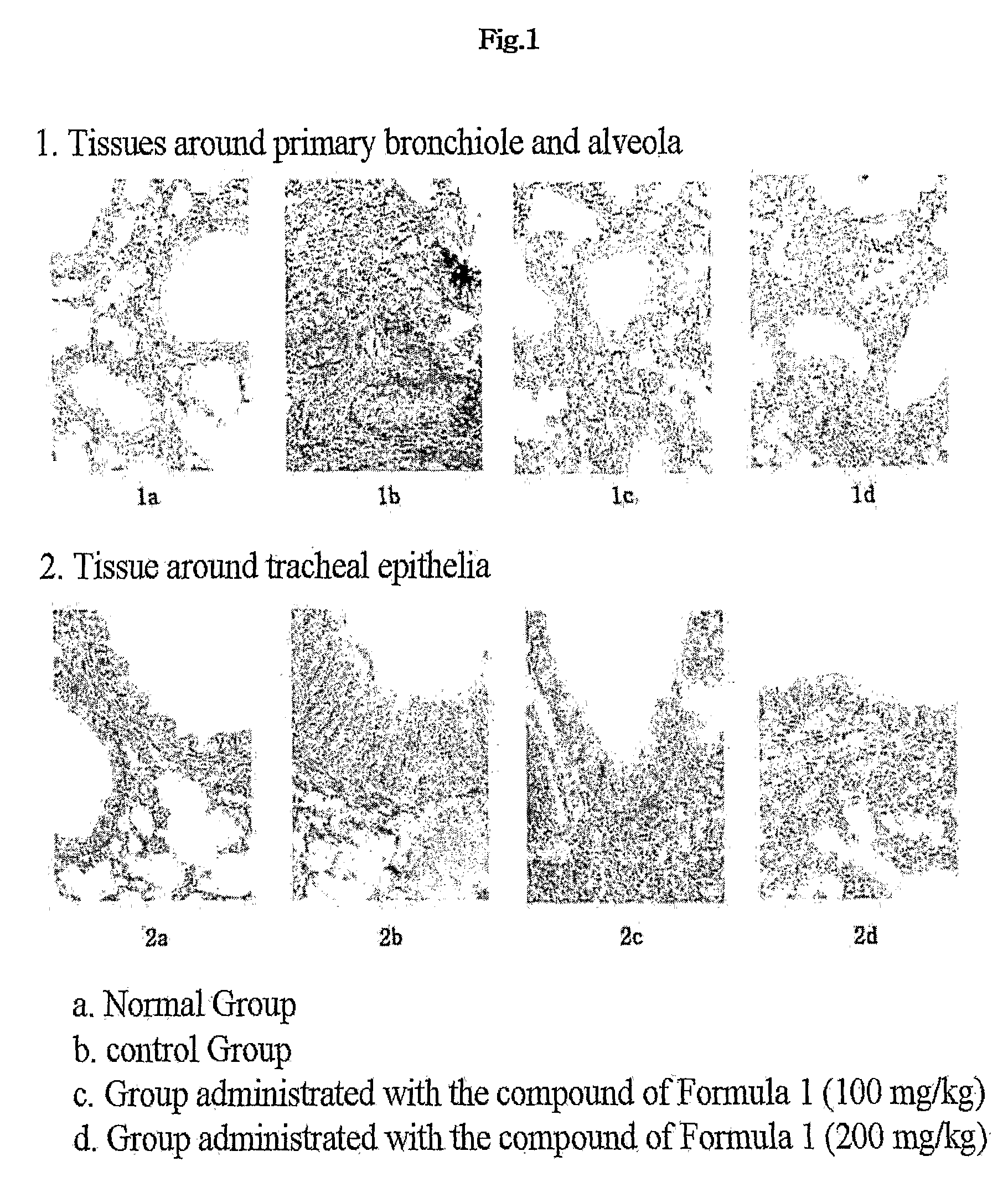 Composition for the Prevention and Treatment of Allergic Inflammatory Disease