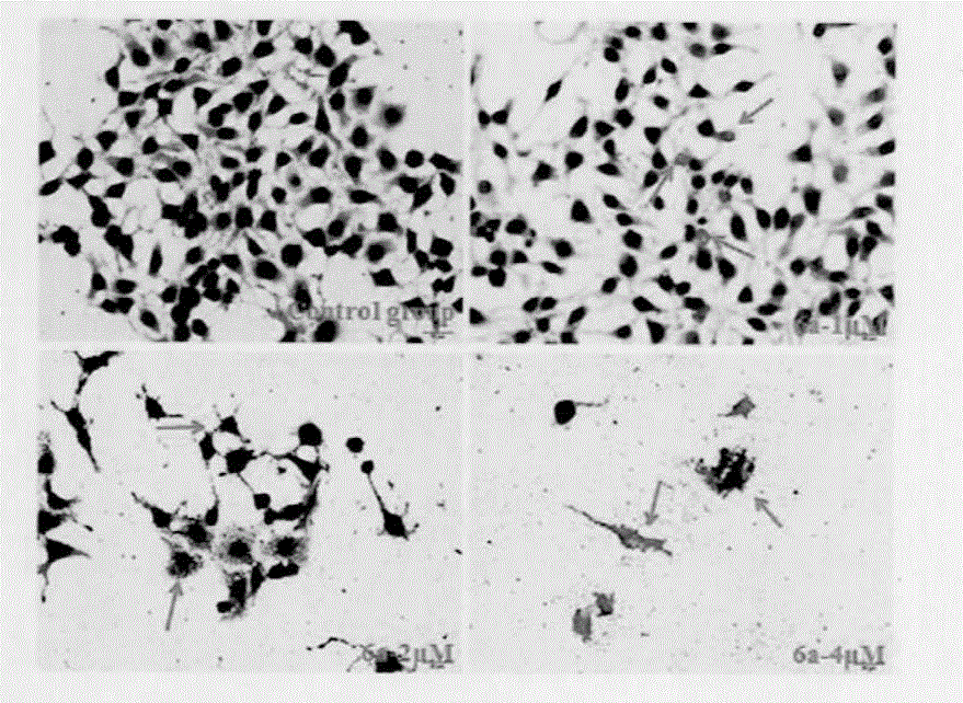 Preparation method and application of antitumor drug X-TOA