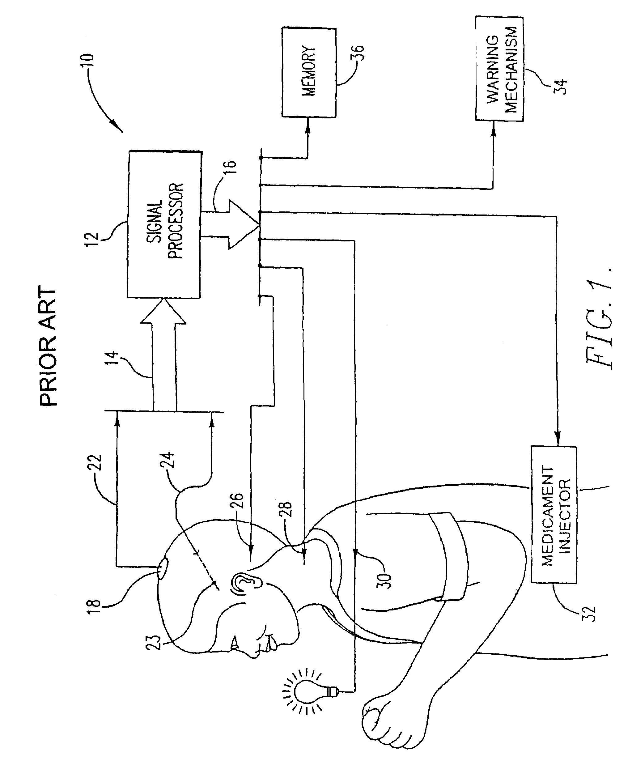 Bi-directional cerebral interface system