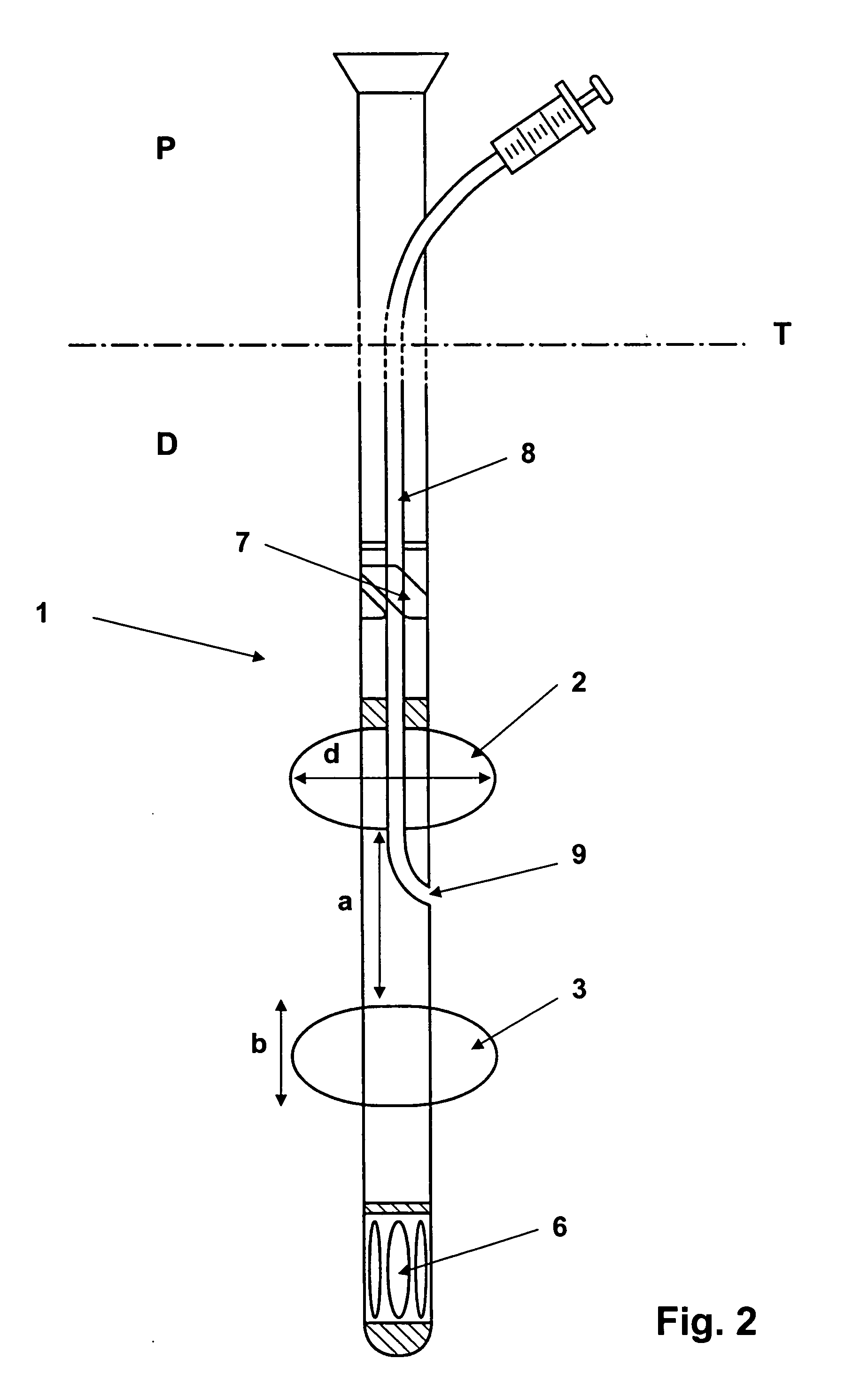 Device for minimally invasive intravascular aortic valve extraction