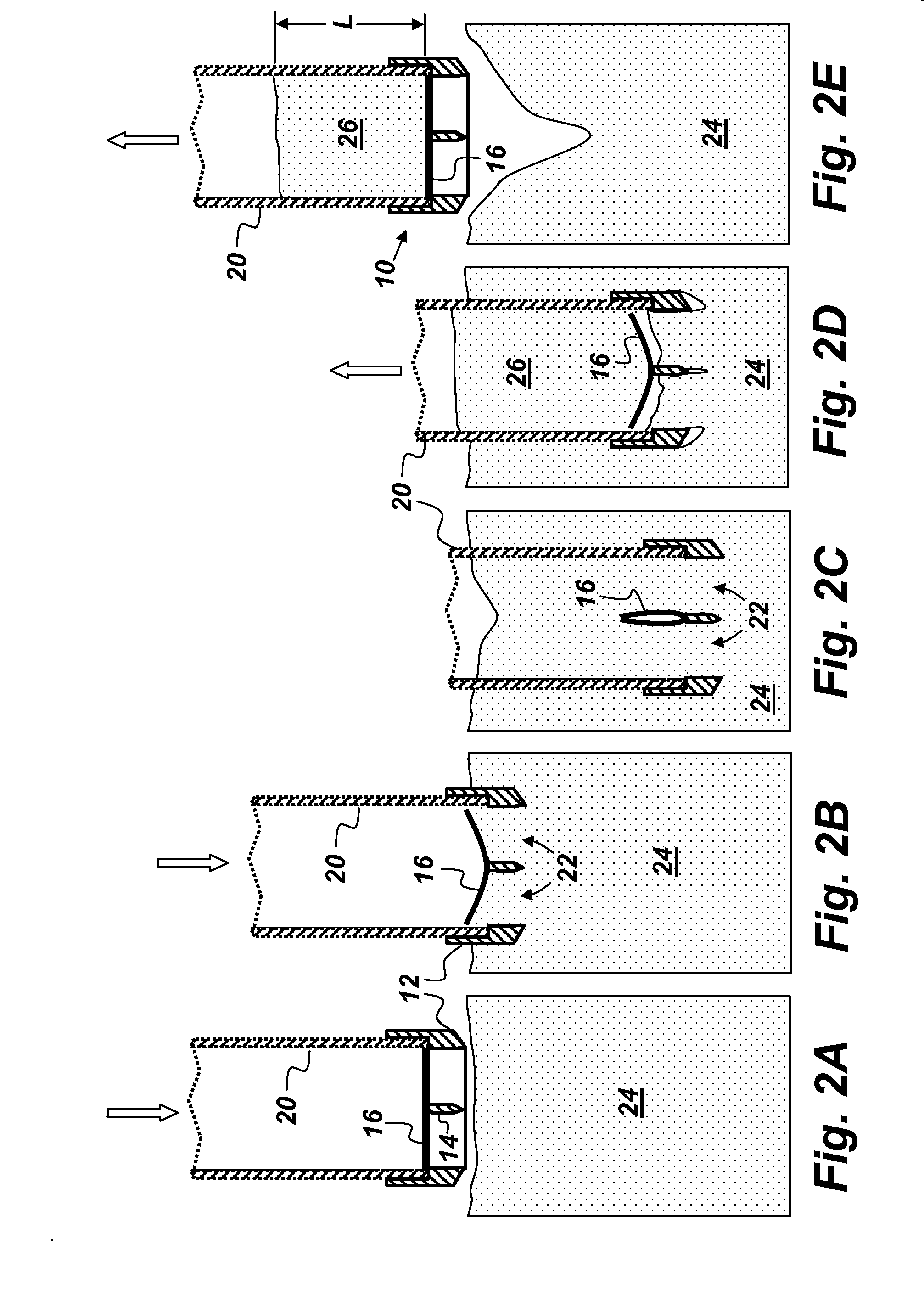 Surface Sediment Core Catcher