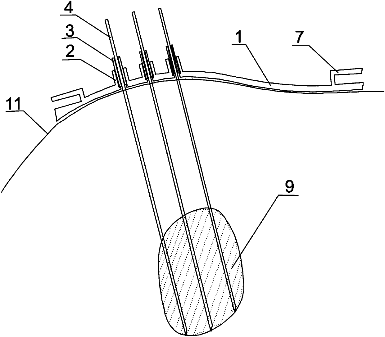 3D printing personalized plunger type puncture treatment template with fixing device