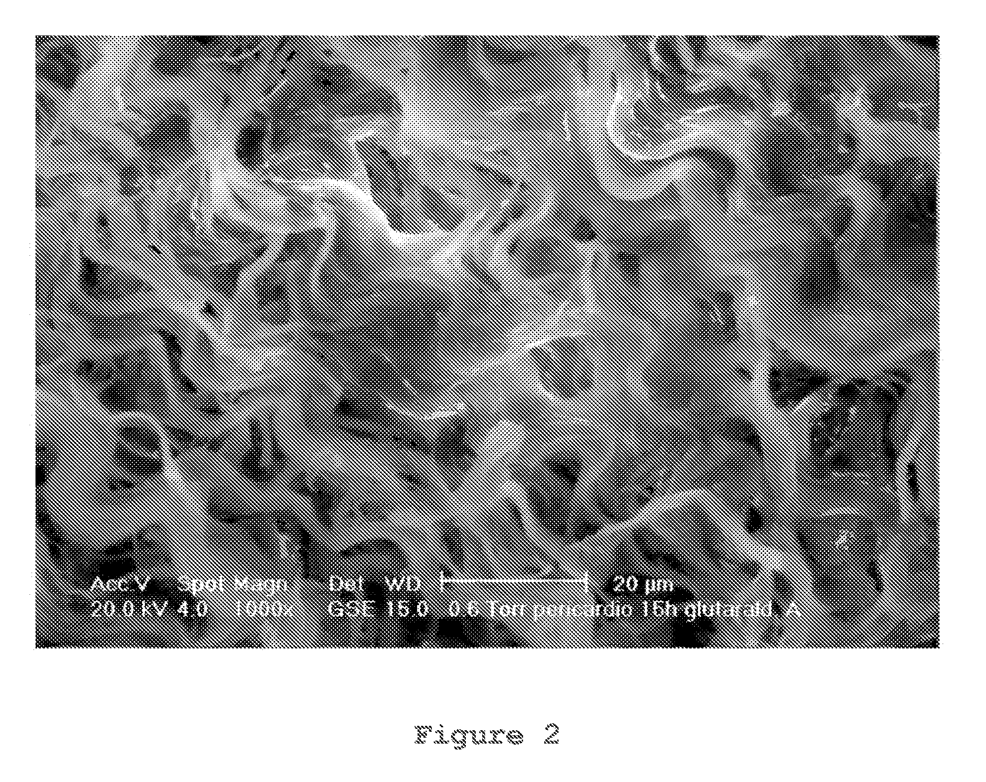 Method of preparing acellularized, biocompatible, implantable material