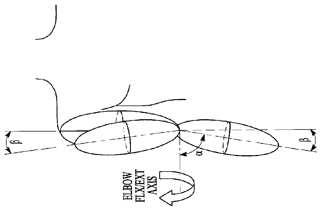 Exoskeleton