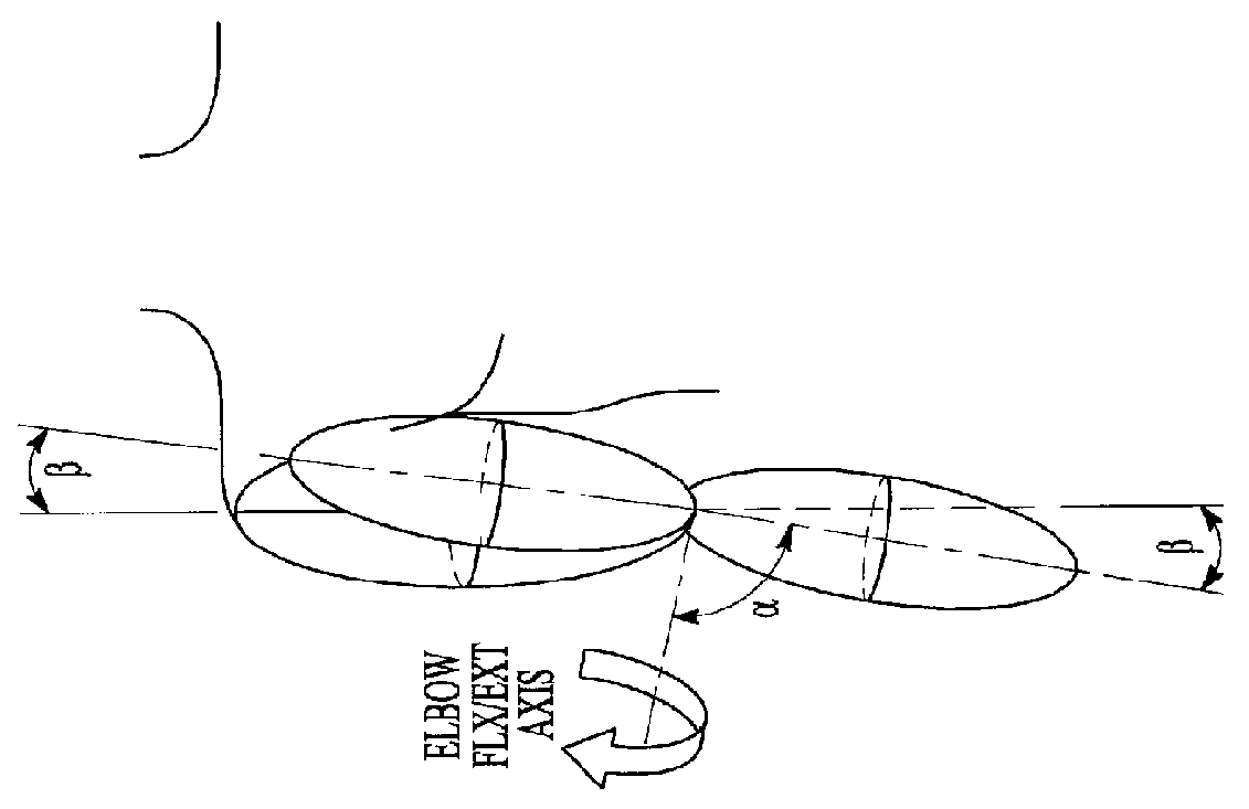 Exoskeleton