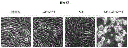 Application of Bcl-xL inhibitor and oncolytic virus to preparation of anti-tumor medicines