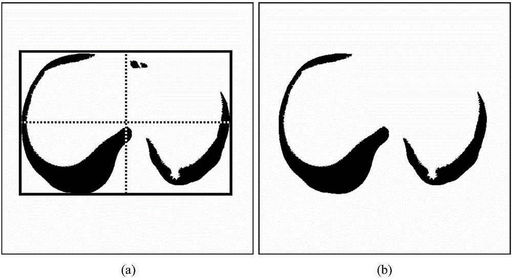 Automatic division method for pulmonary parenchyma of CT image