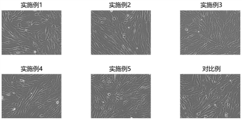 Stem cell serum-free culture medium and preparation method and application thereof