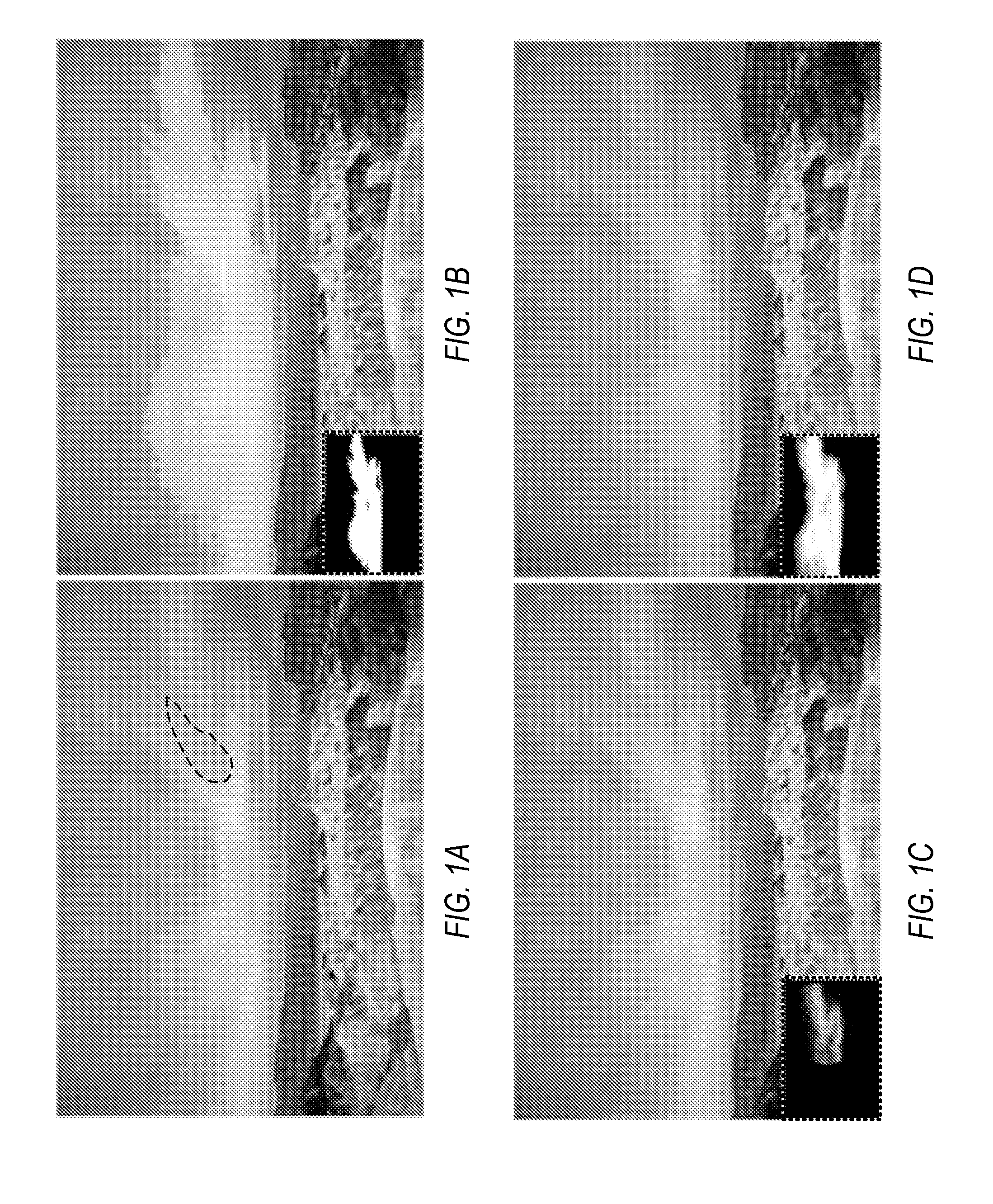 Fast Adaptive Edge-Aware Matting