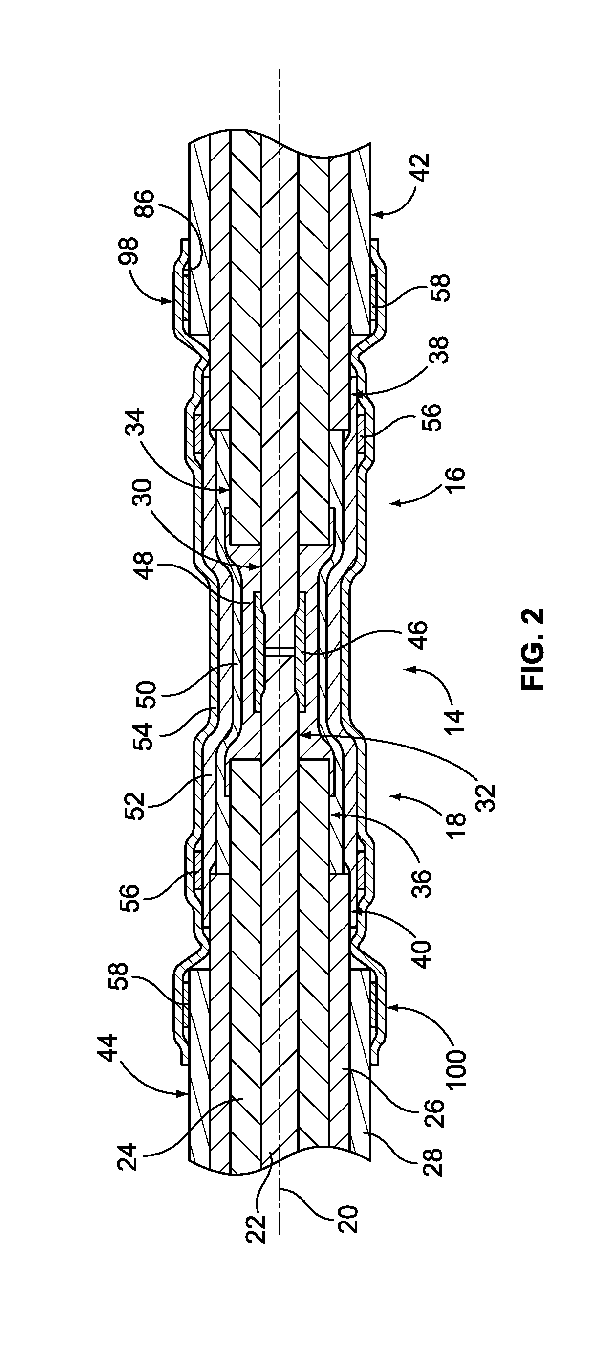 Cable Repair Splice