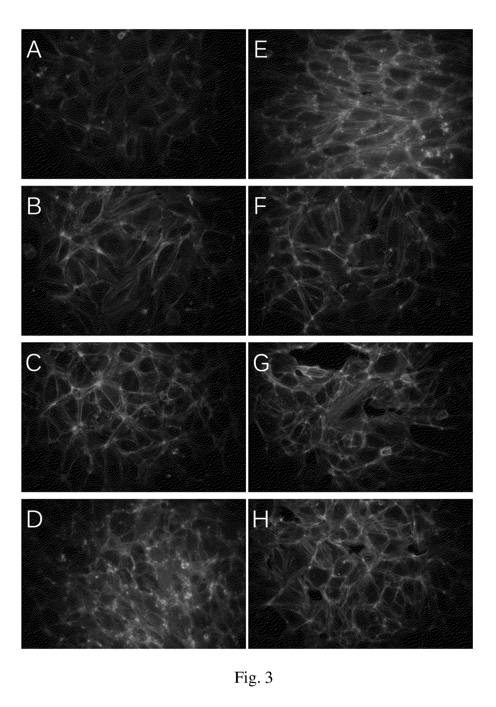 Methods of treatment of diseases