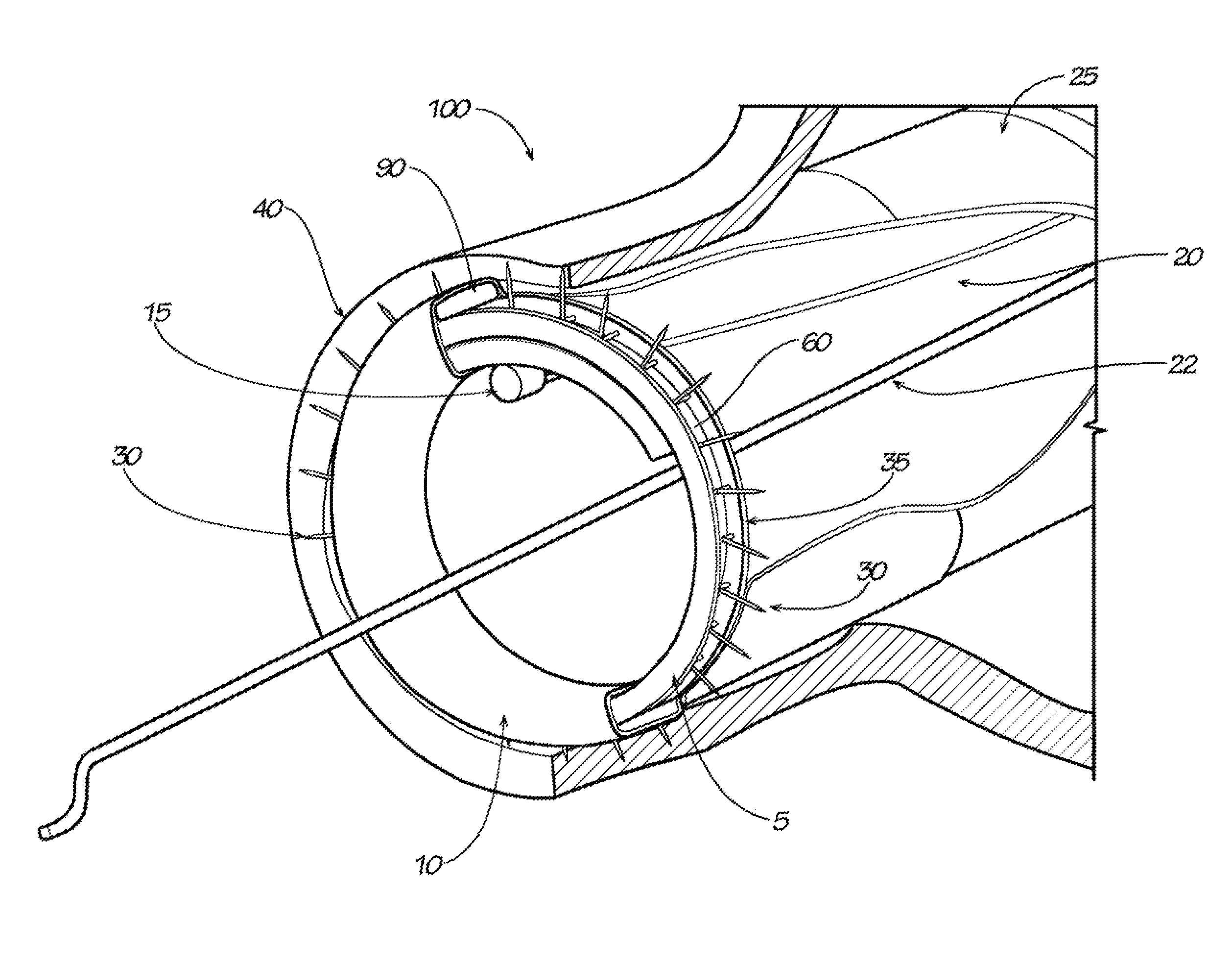 Surgical implant devices and methods for their manufacture and use