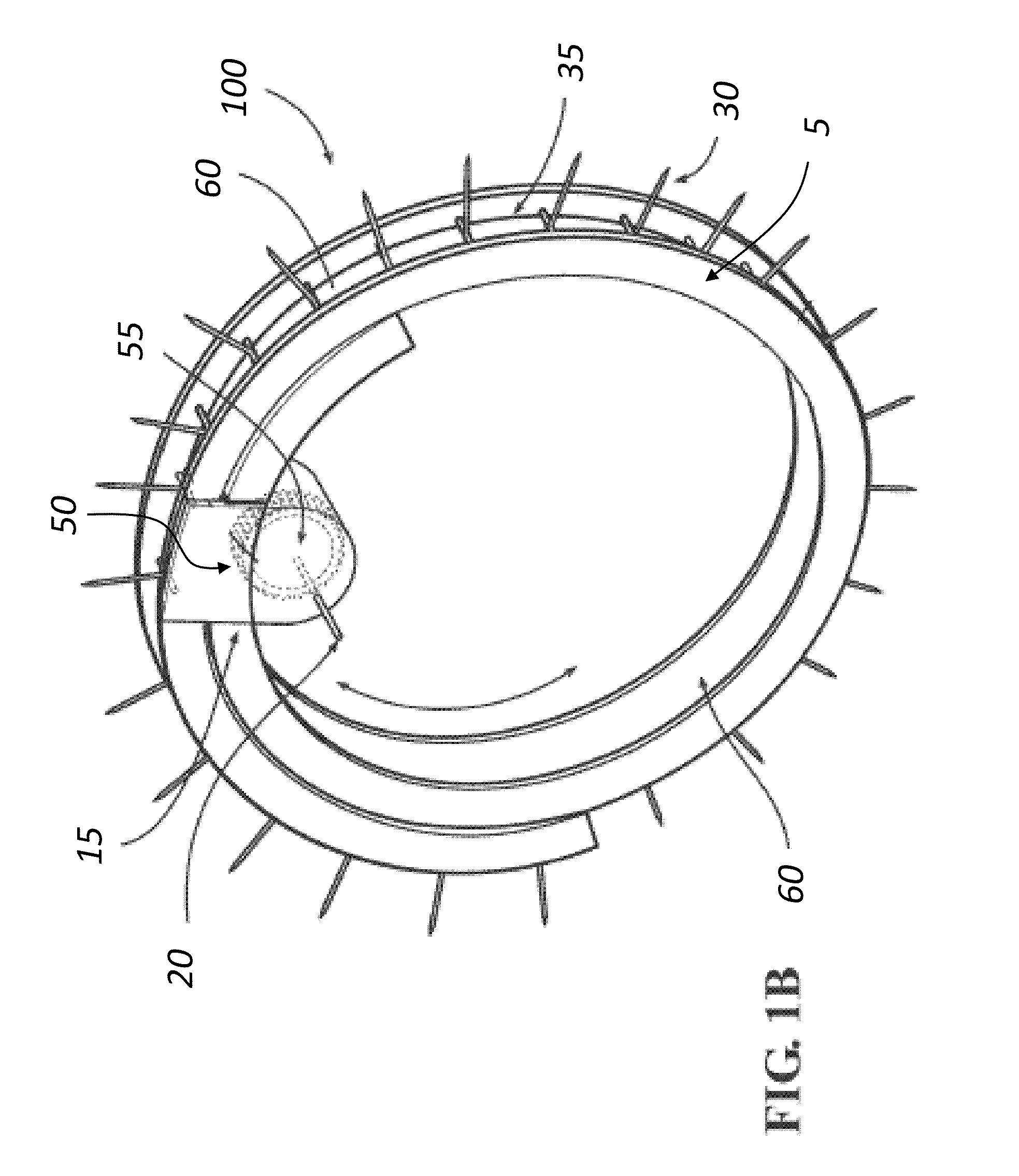 Surgical implant devices and methods for their manufacture and use