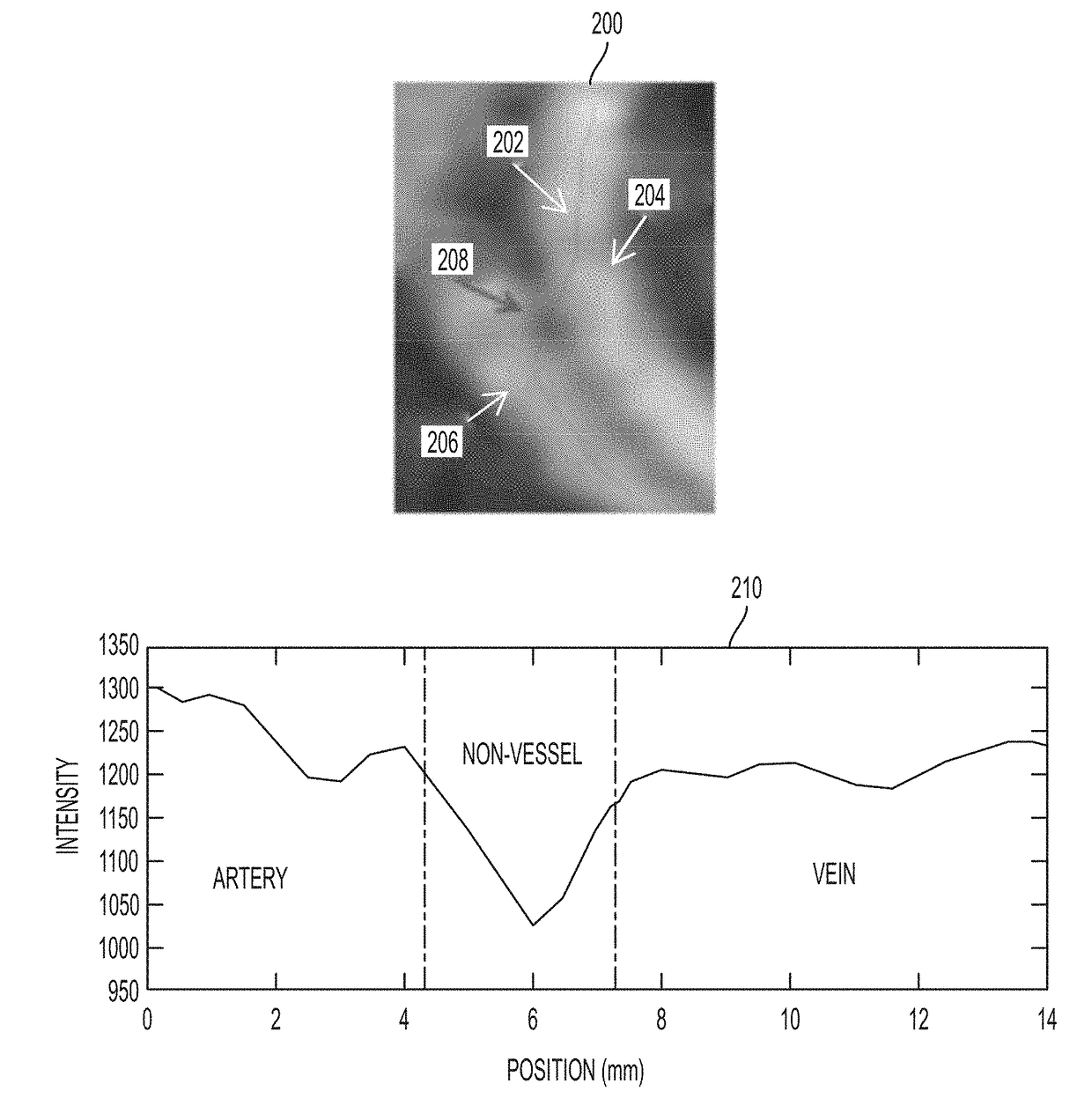 Method and System for Machine Learning Based Classification of Vascular Branches