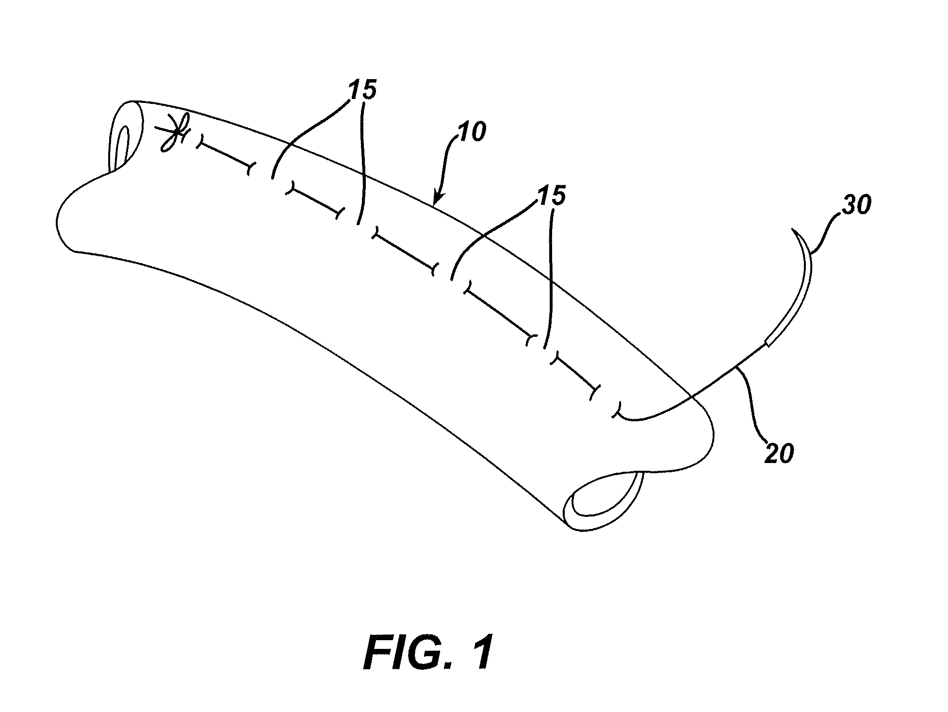 Methods and devices for the rerouting of chyme to induce intestinal brake