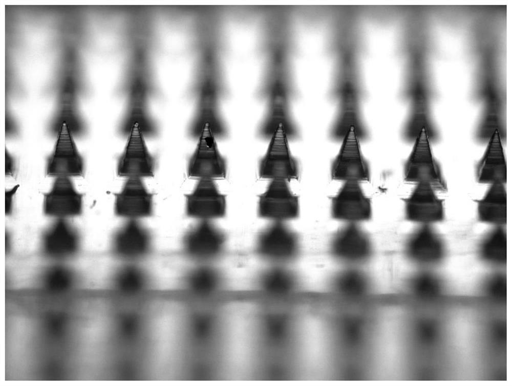 Separable hydrogel microneedle loaded with recombinant human fibronectin as well as preparation method and application of separable hydrogel microneedle