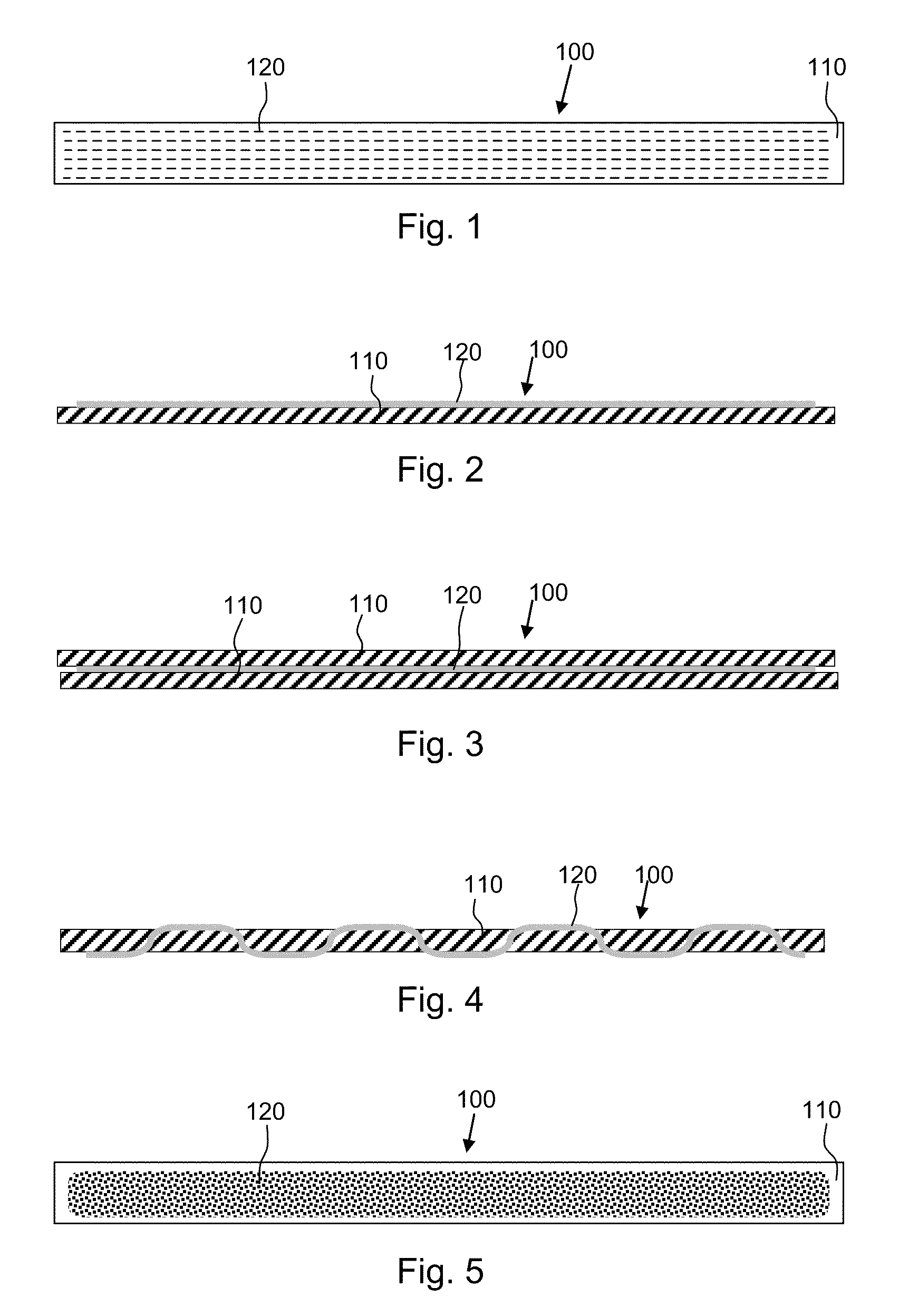 Composite surgical implants for soft tissue repair