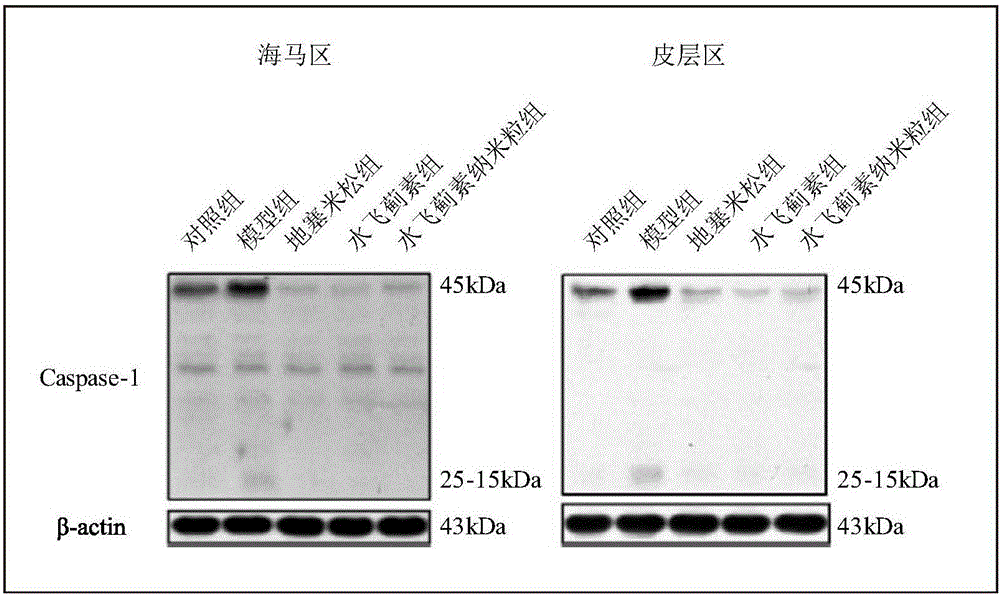 Preparation and application of silymarin lipid nanoparticles