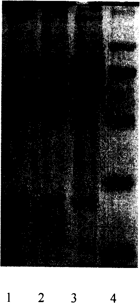 Method for removing high abundance protein using gold magnetic particle