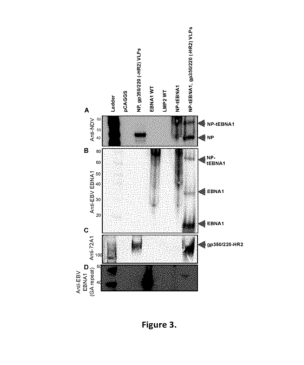 Virus-like particle compositions and vaccines against Epstein-Barr virus infection and disease