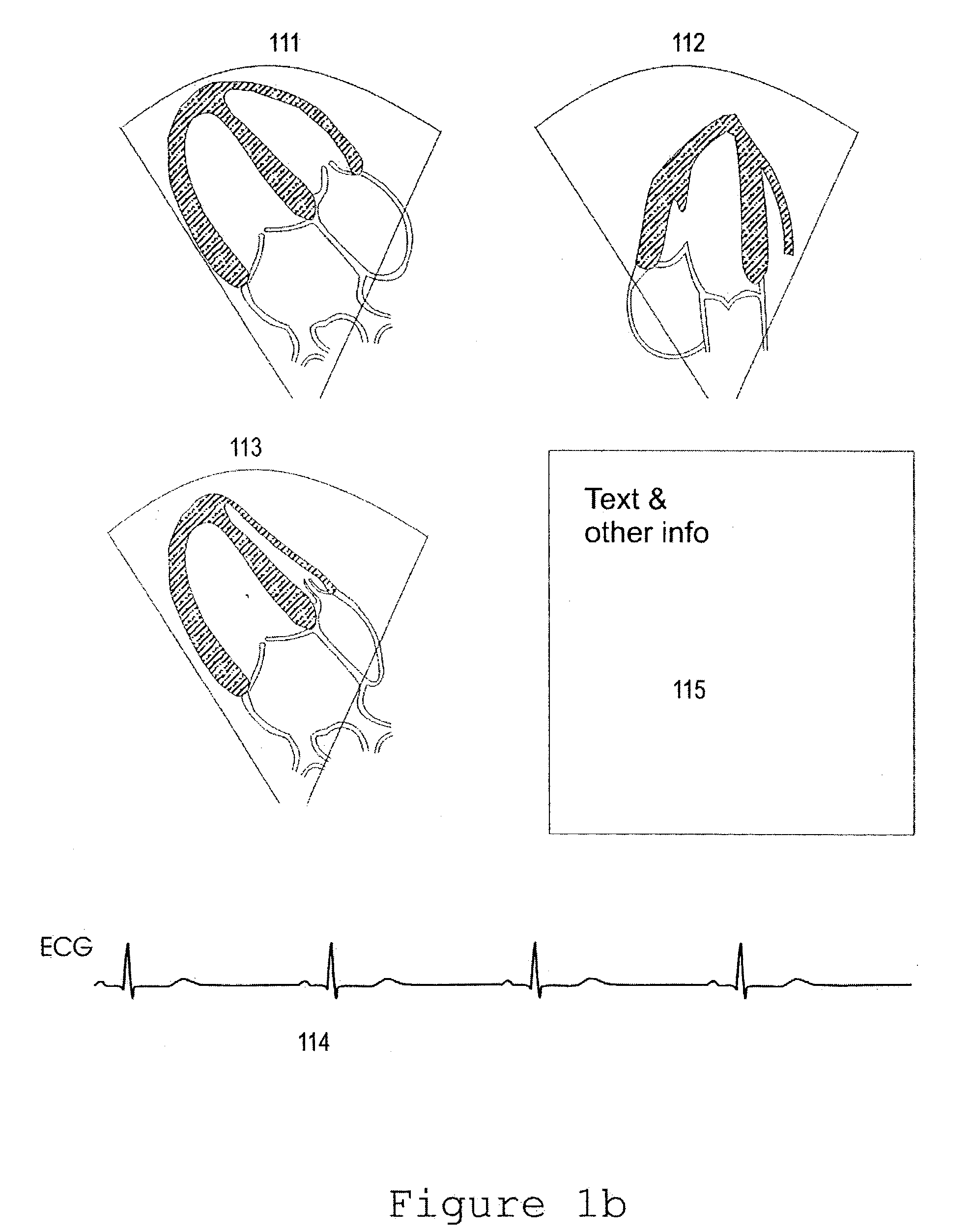 Multiple scan-plane ultrasound imaging of objects