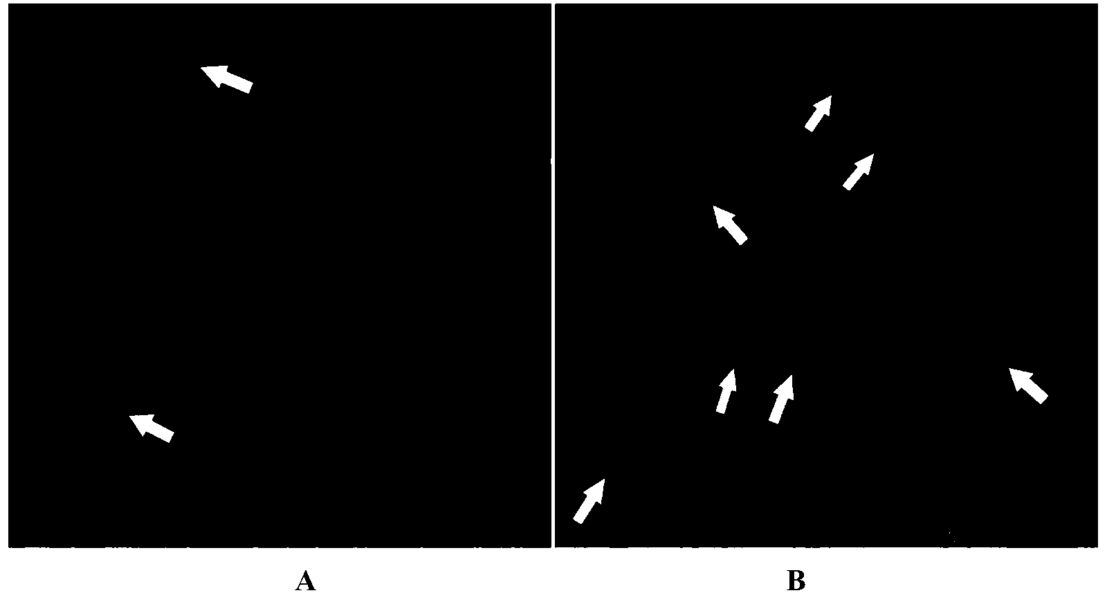 Application of metrn1 protein in aspect of preparation of lipid-lowering drug