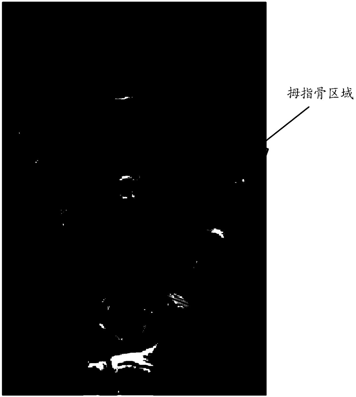 A method and apparatus for detecting bone age