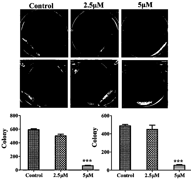 Application of cytotoxic active spider peptide to research and development of anti-tumor medicine