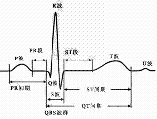 Automatic electrocardiogram recognition system