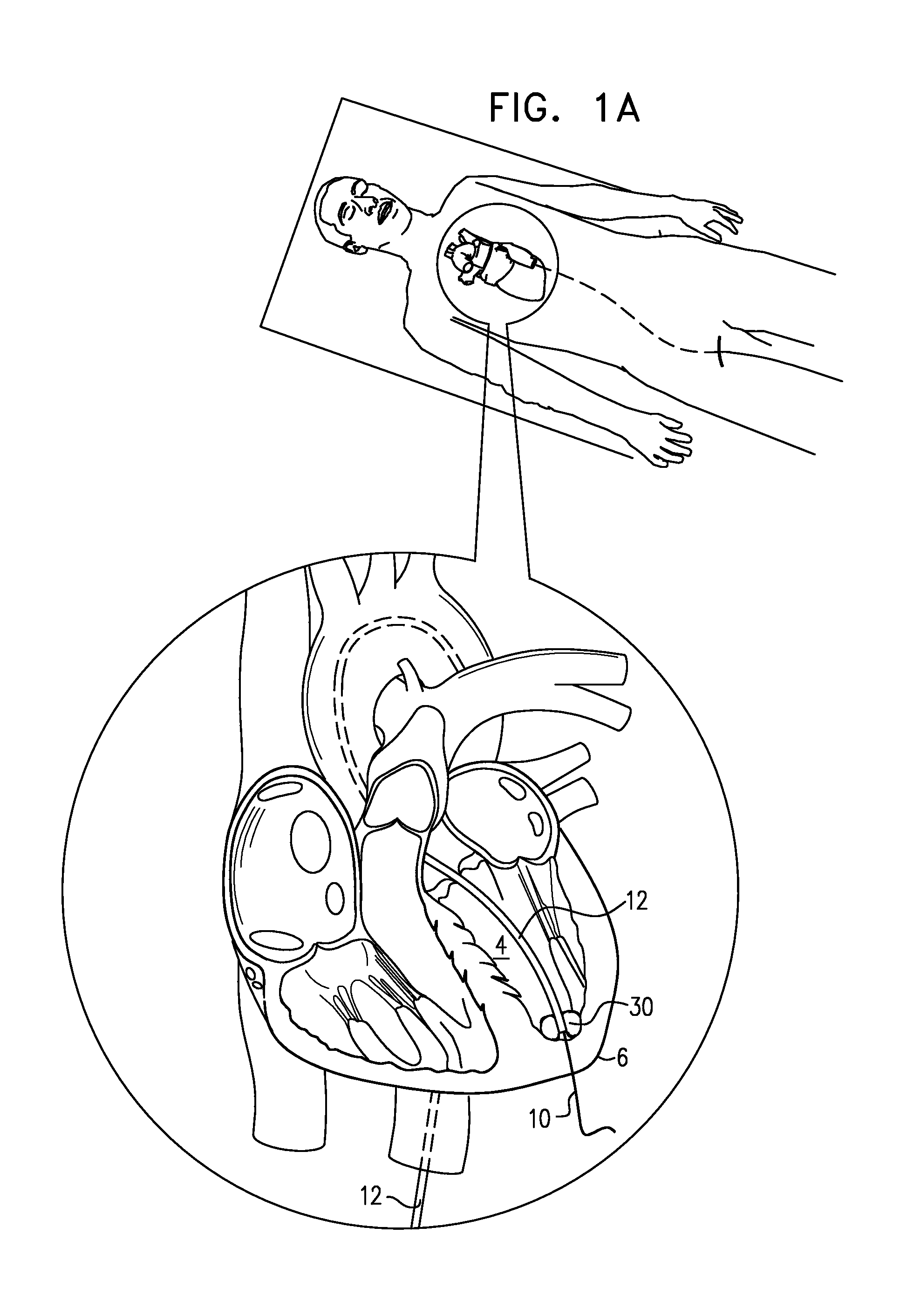 Minimally invasive surgical techniques