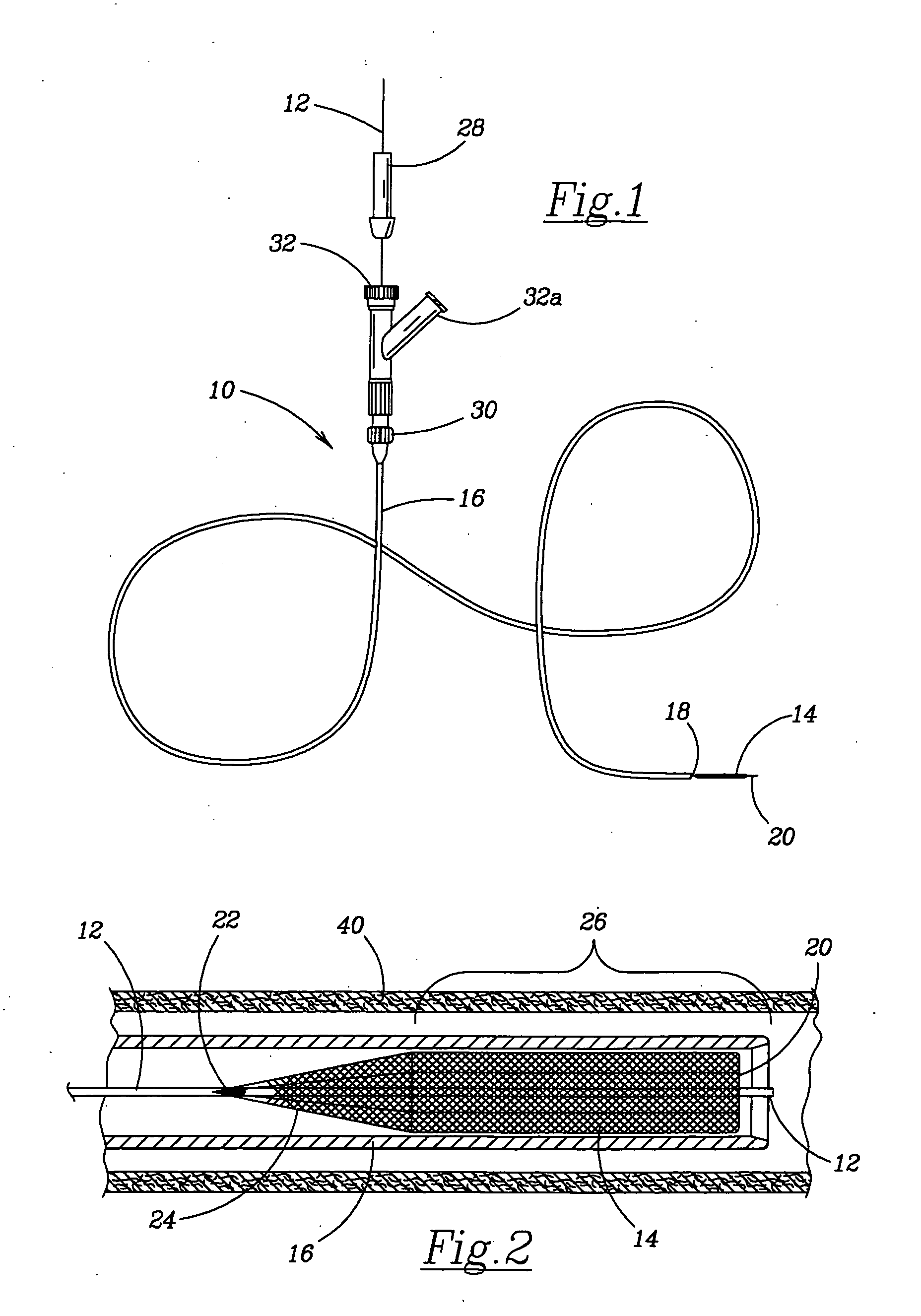 Retractable flow maintaining stent wire