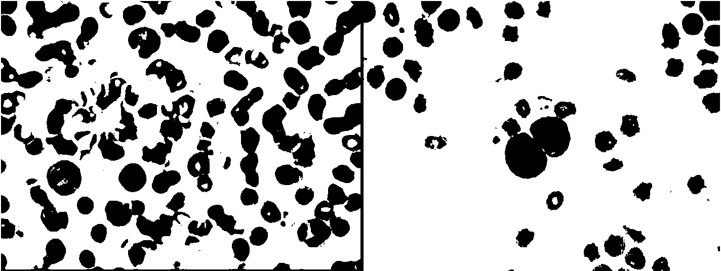 Adherent white blood cell segmentation method based on nucleus-marked watershed transformation