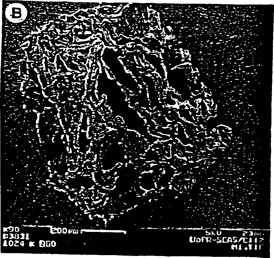 Human ex vivo immune system