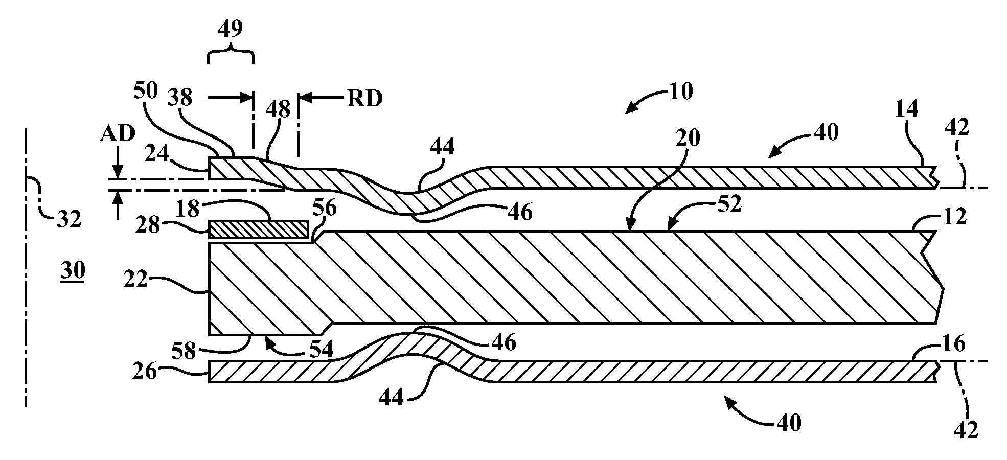 Cylinder head gasket