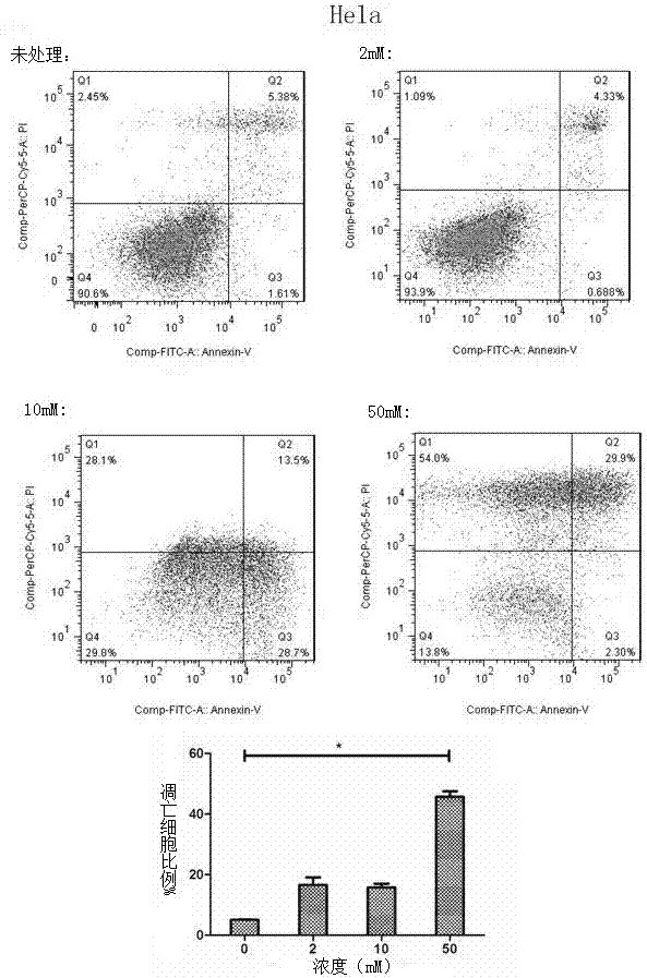 Application of metformin in preparation of drug for cervical cancer