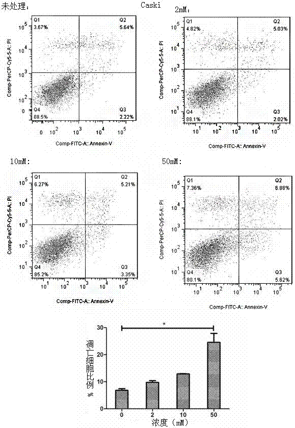 Application of metformin in preparation of drug for cervical cancer