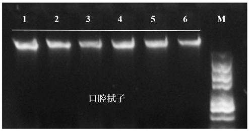 Magnetic bead-based DNA extraction method, lysate and kit