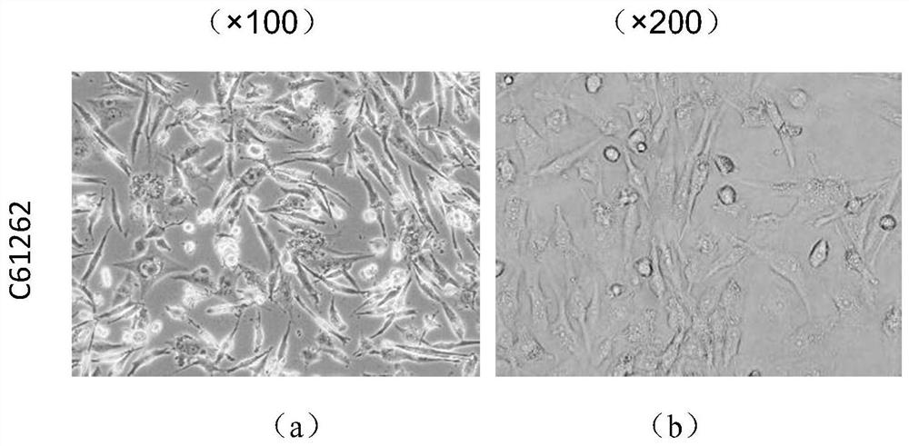 A gastric cancer cell line with high metastatic potential and its establishment method and application