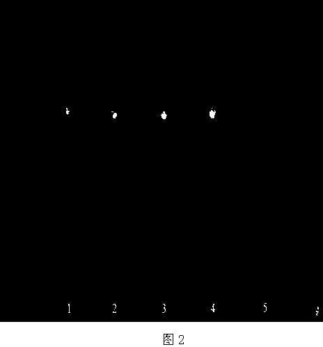 Method for detecting medicine for treating irritable bowel syndrome