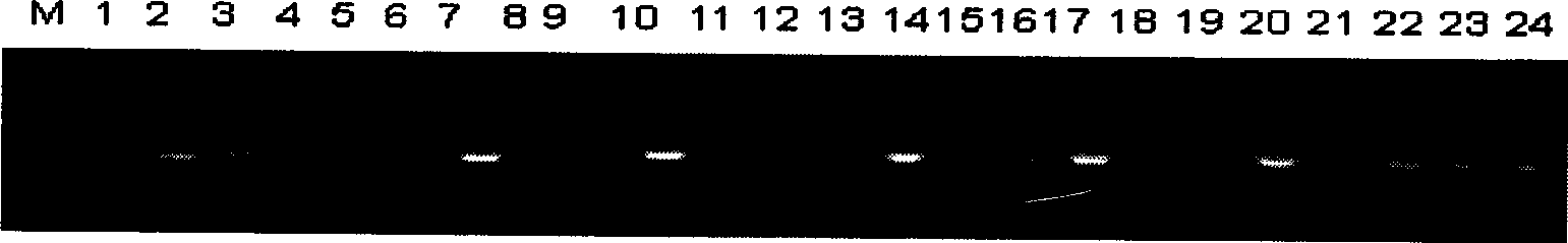 Gentiana straminea beta-amyrin synthetase gene GsAS2 and use thereof