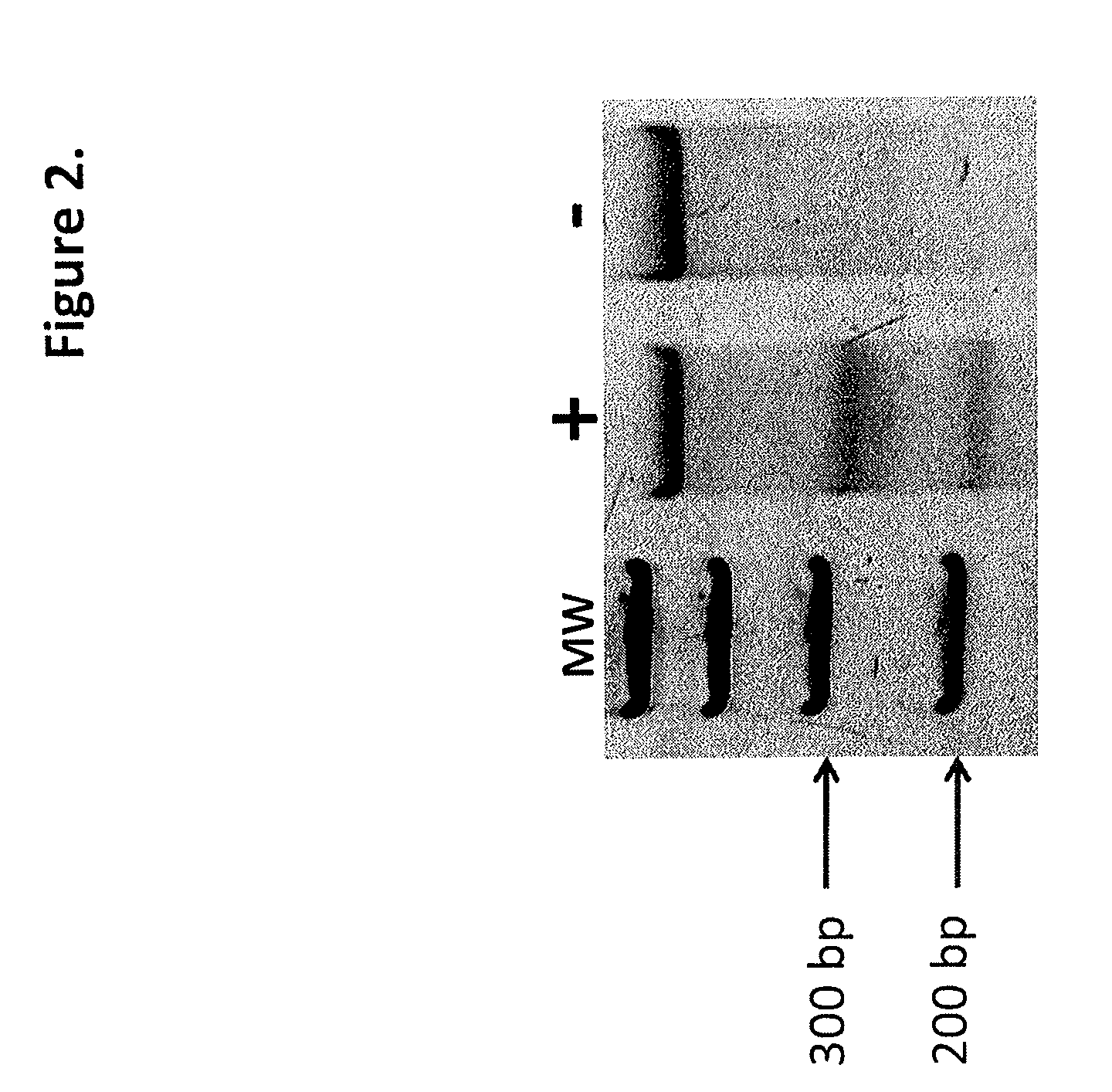 TALEN-based gene correction