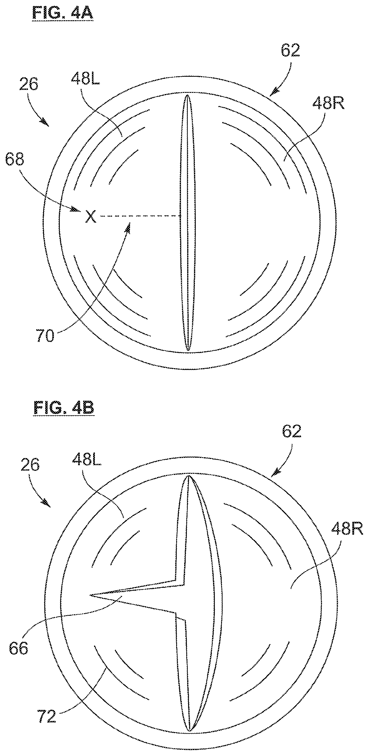 Bicuspid valve dissection device