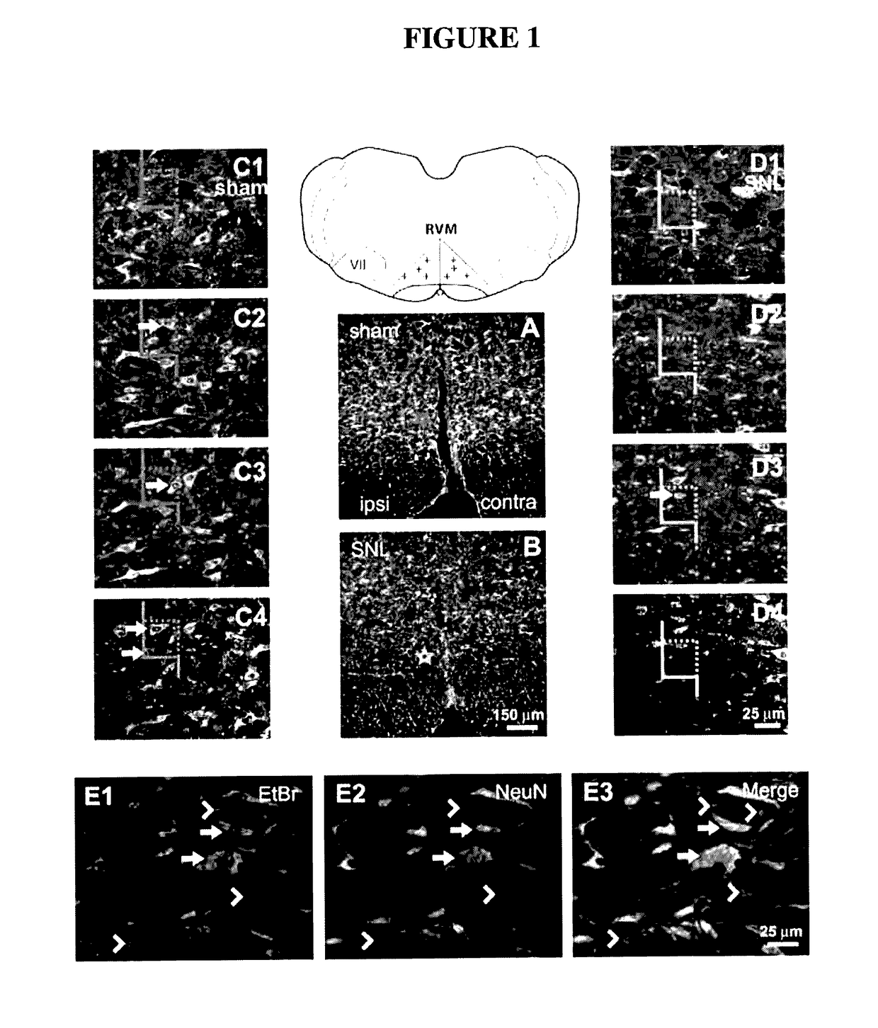 Prevention or attenuation of neuropathic pain by bile acids