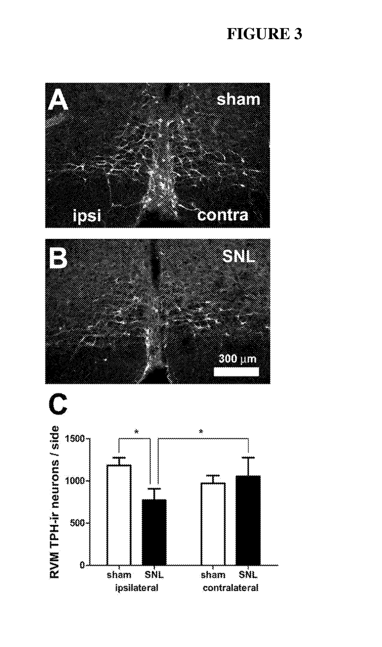 Prevention or attenuation of neuropathic pain by bile acids