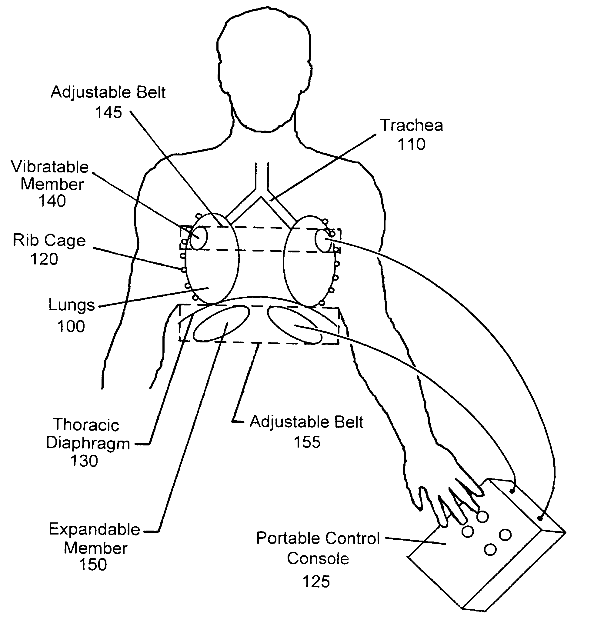 Device for clearing mucus from the pulmonary system