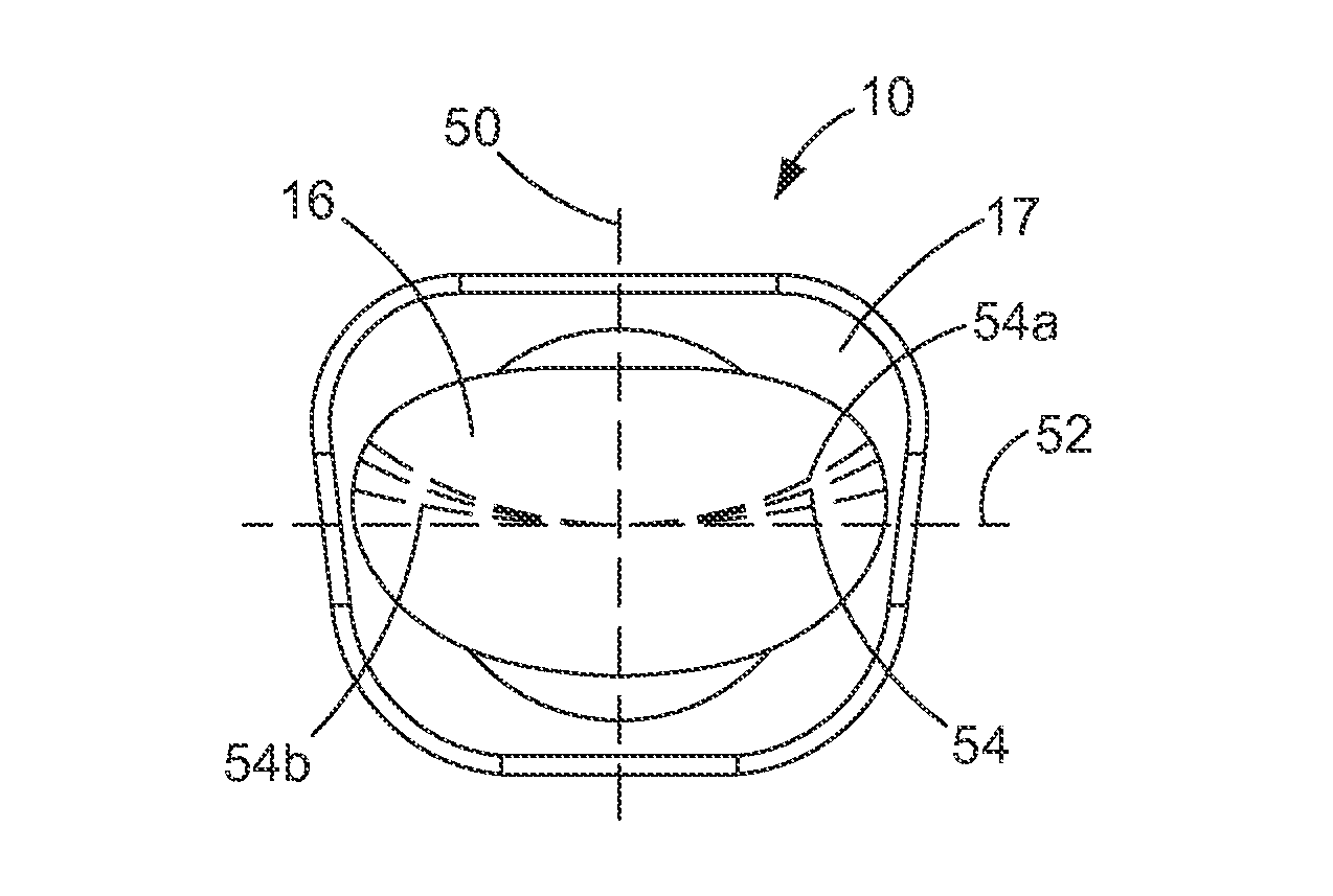 Articulating disc implant