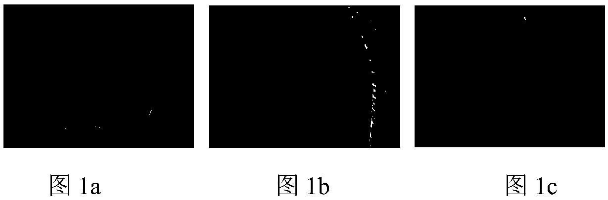 Gradient distribution-based non-rigid medical image registration method