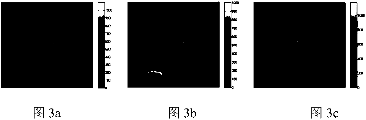 Gradient distribution-based non-rigid medical image registration method